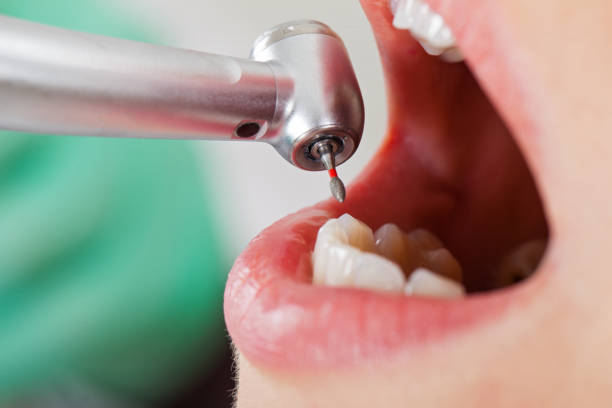 Best Emergency Dental Care for Broken or Chipped Teeth in Ranger, TX